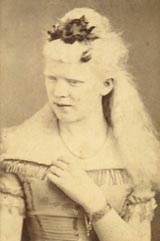 19th-century woman with albinism