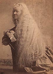 19th-century woman with albinism